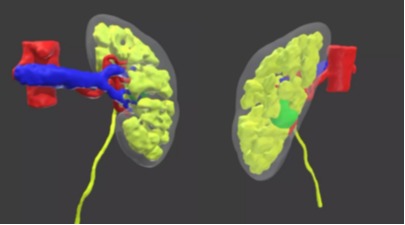 immagine di 2 reni e una mano robotica - stile disegno