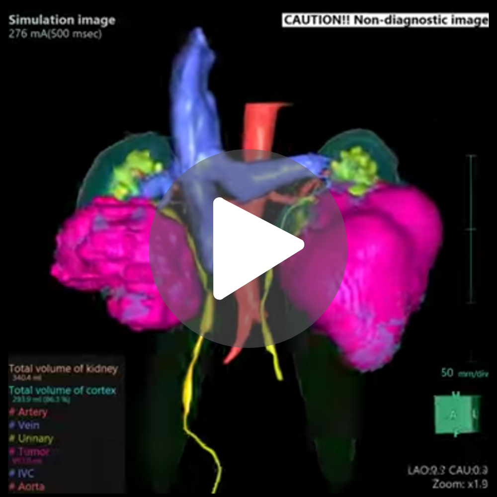 Fermo immagine del viedo di animazione in 3d dei reni